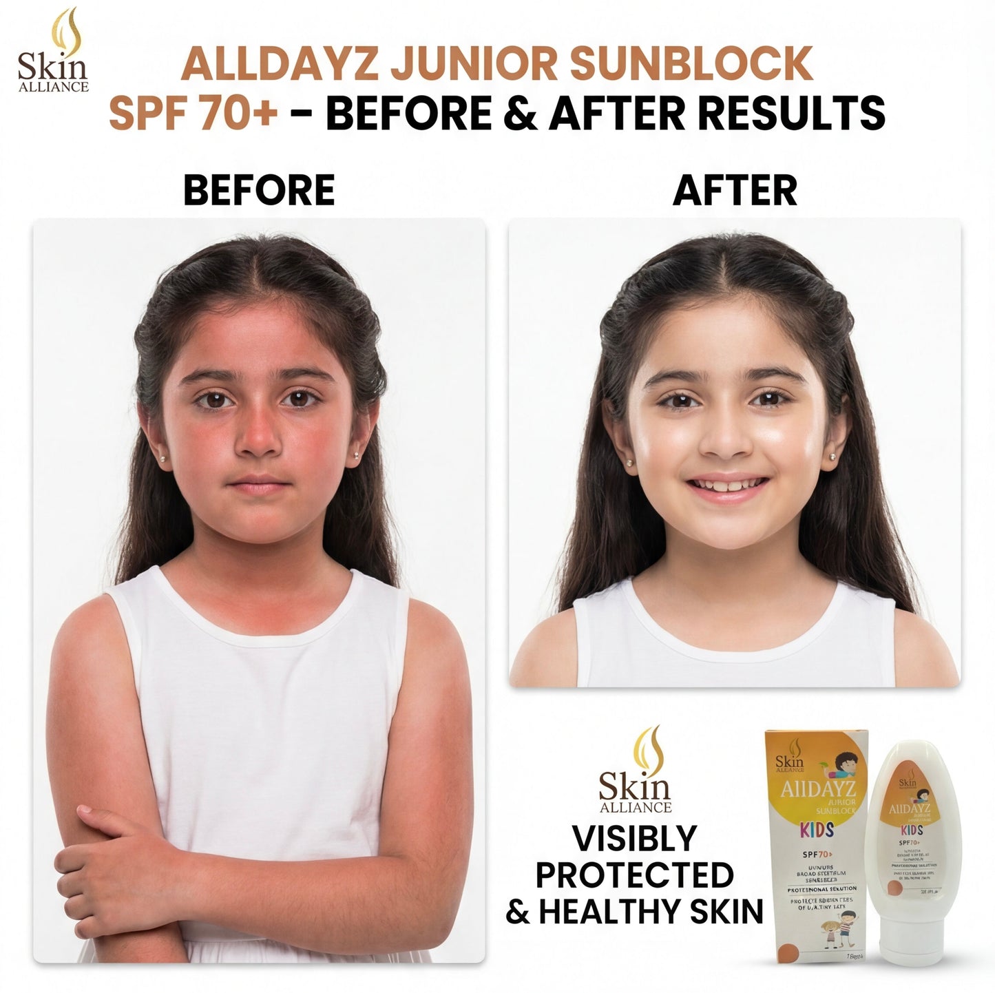 Alldayz Junior Sunblock SPF 70+