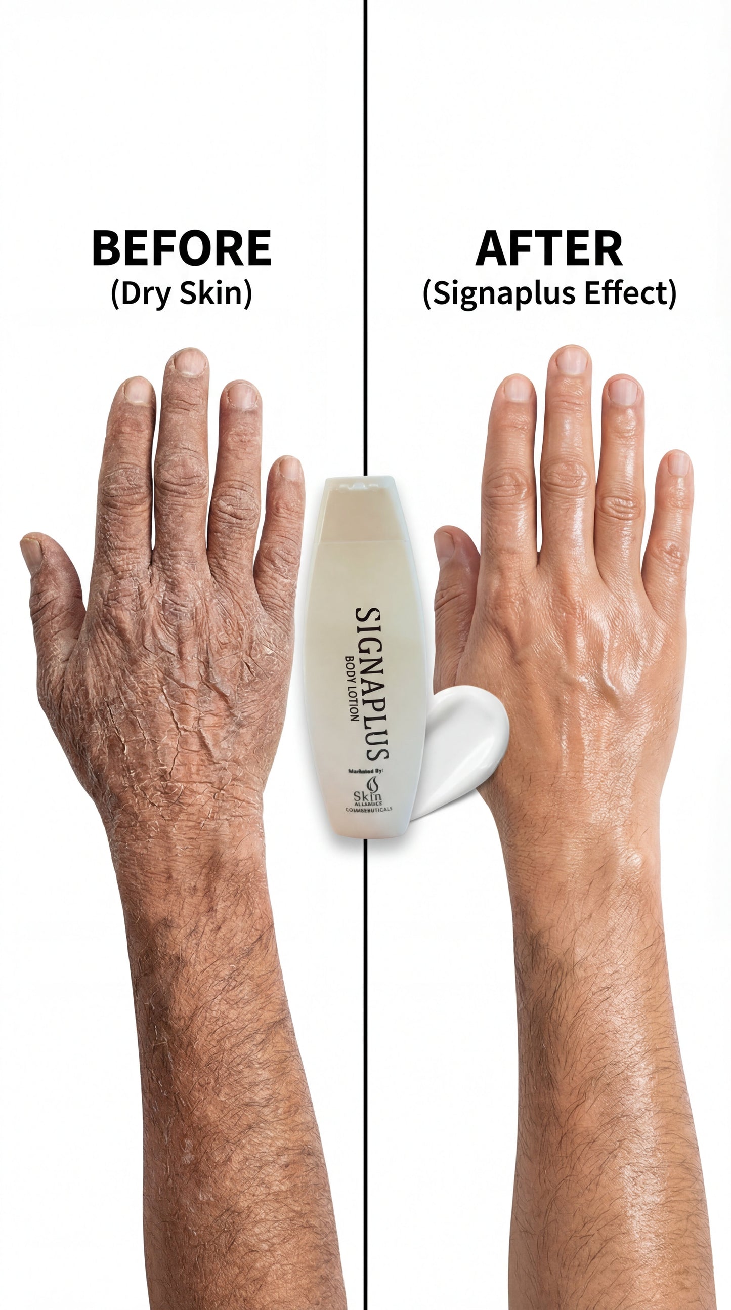 SignaPlus Body Moisturiser Lotion