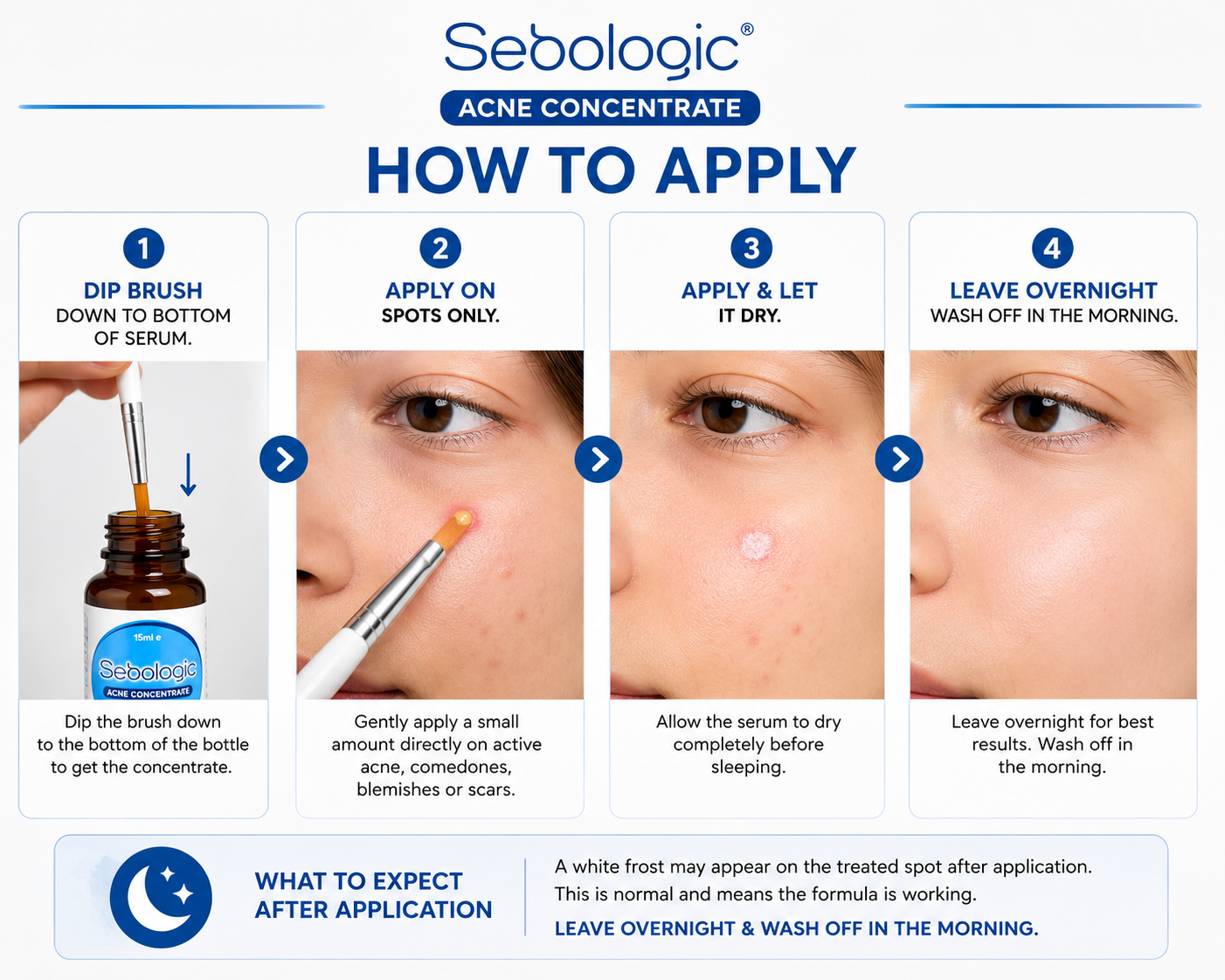 Sebologic Acne Concentrate Serum | Targeted Spot Treatment for Active Acne, Comedones, Blemishes & Post-Acne Marks