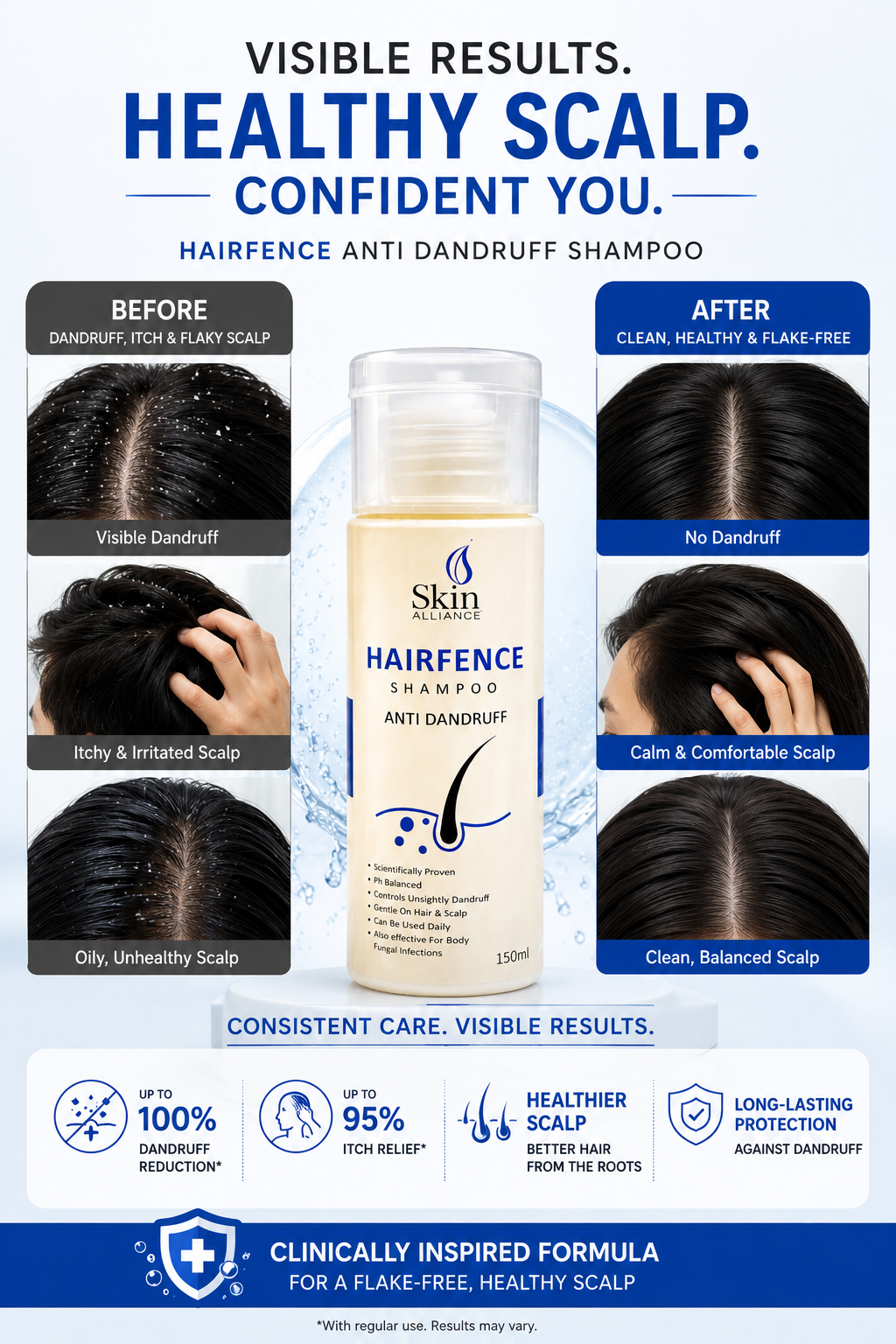 HairFence Anti-Dandruff Shampoo | Scalp Care Shampoo for Dandruff, Itchy Scalp, Flakes & Fungal Scalp Care | pH Balanced Daily Use | 150ml