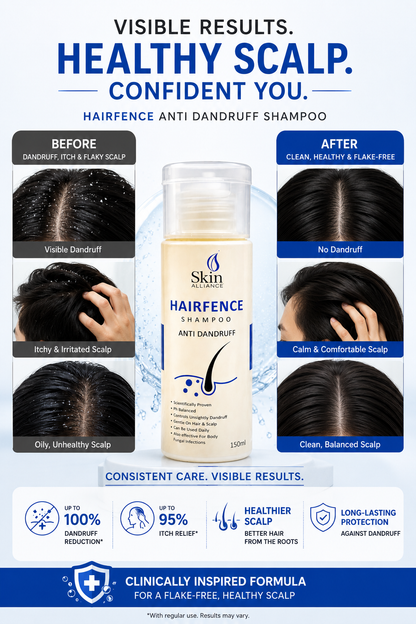 HairFence Anti-Dandruff Shampoo | Scalp Care Shampoo for Dandruff, Itchy Scalp, Flakes & Fungal Scalp Care | pH Balanced Daily Use | 150ml