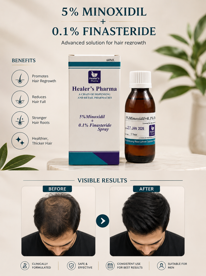 5% Minoxidil 0.1% Finasteride Hair Spray