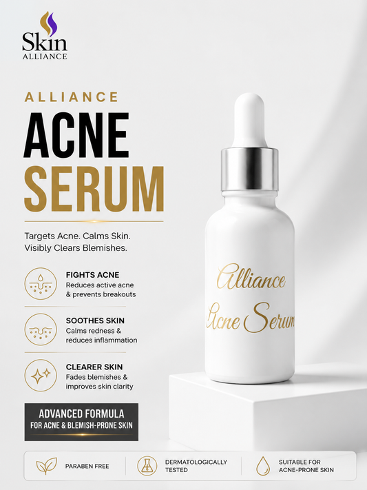 Alliance Acne Control Serum – Anti Acne, Pimple & Acne Marks Treatment Serum
