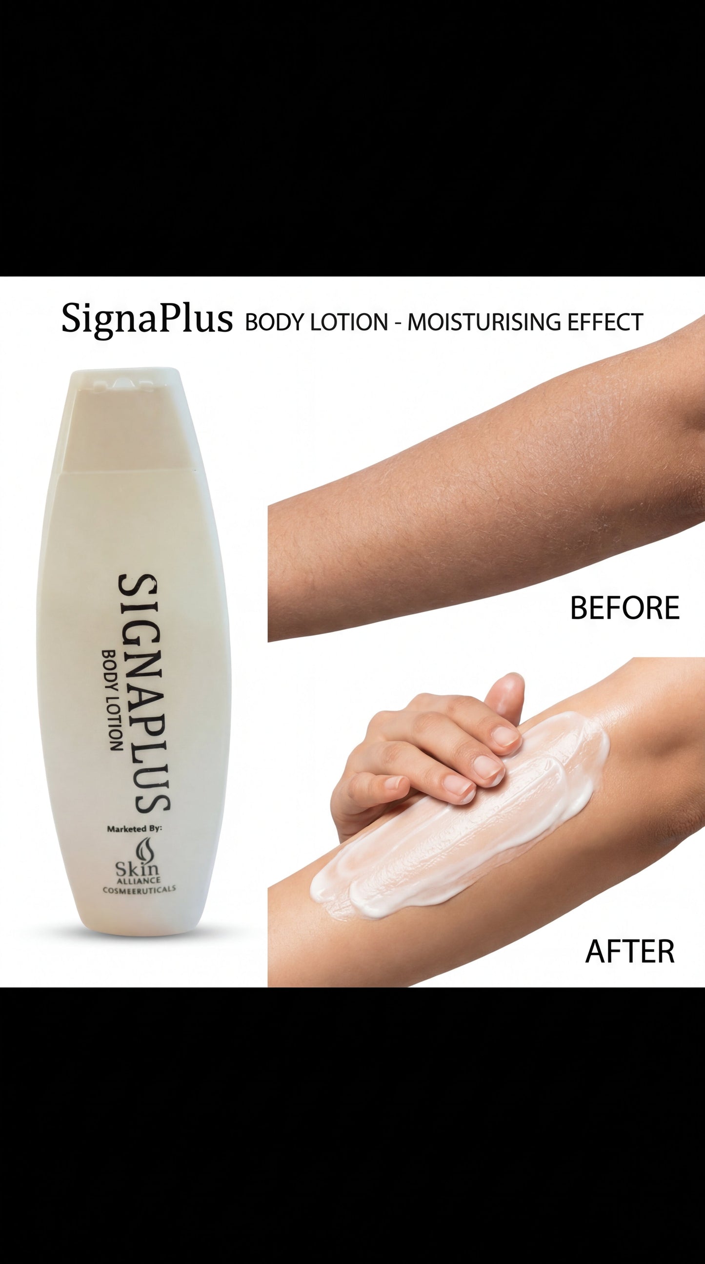 SignaPlus Body Moisturiser Lotion
