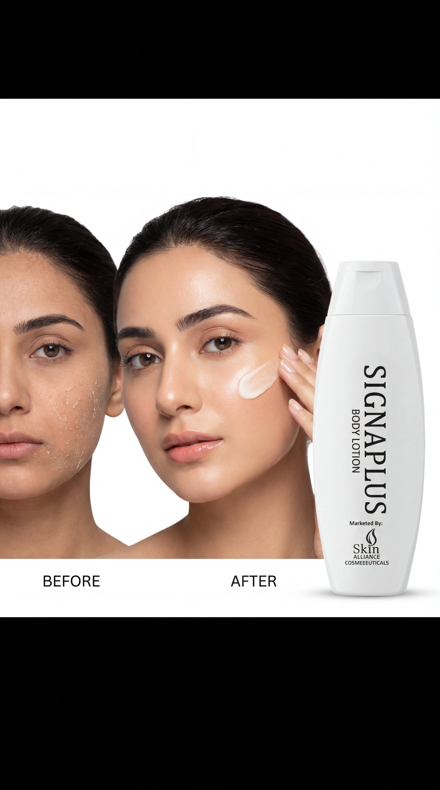 SignaPlus Body Moisturiser Lotion