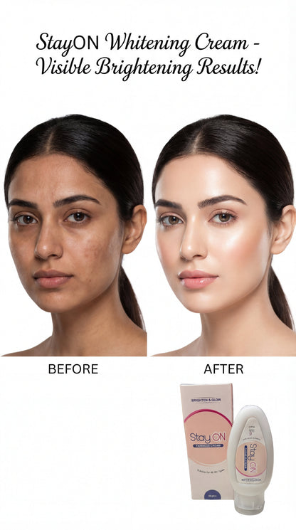 StayON Fairness & Glow Cream | Glutathione, Vitamin C, Arbutin & Melavoid | For Melasma, Pigmentation & Uneven Skin Tone