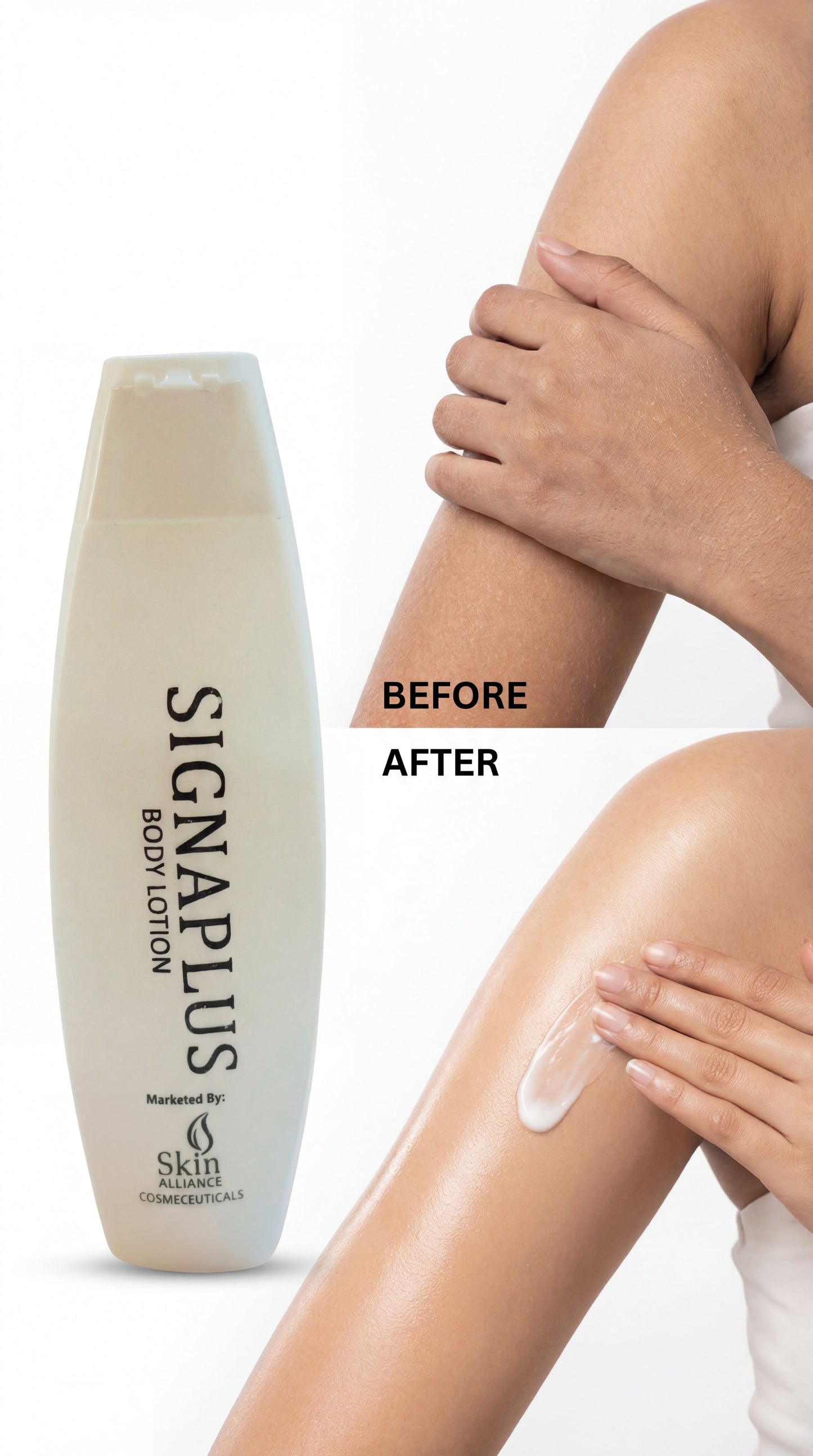 SignaPlus Body Moisturiser Lotion