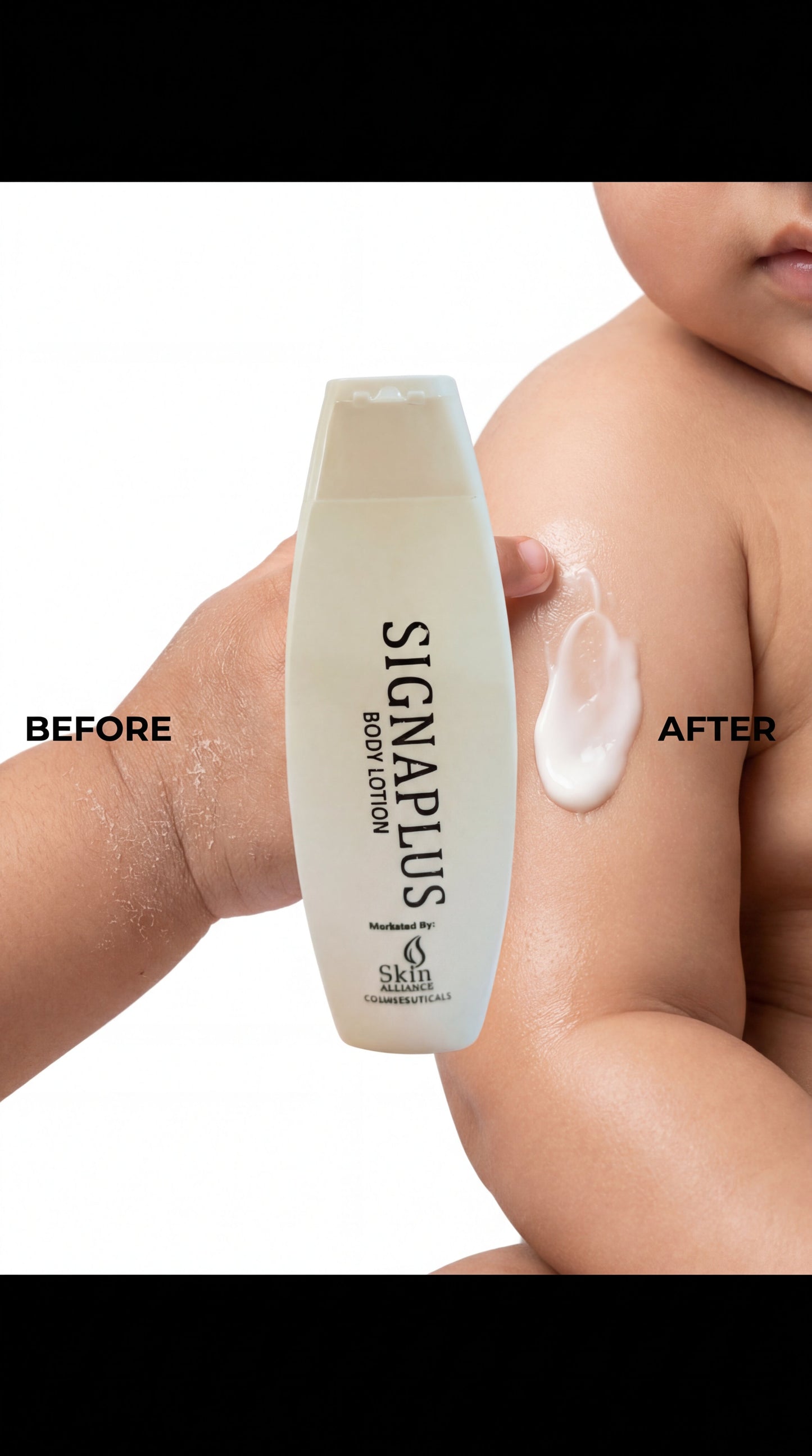SignaPlus Body Moisturiser Lotion