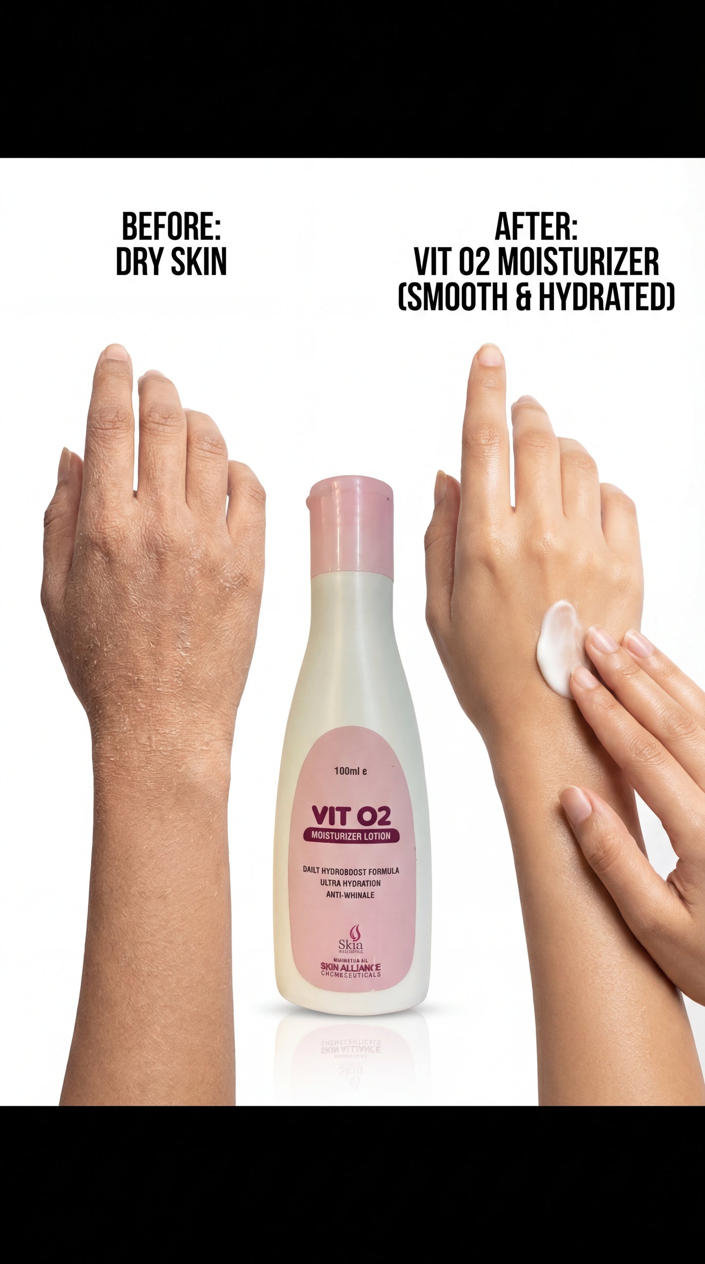 Vit O2 Moisturiser Lotion