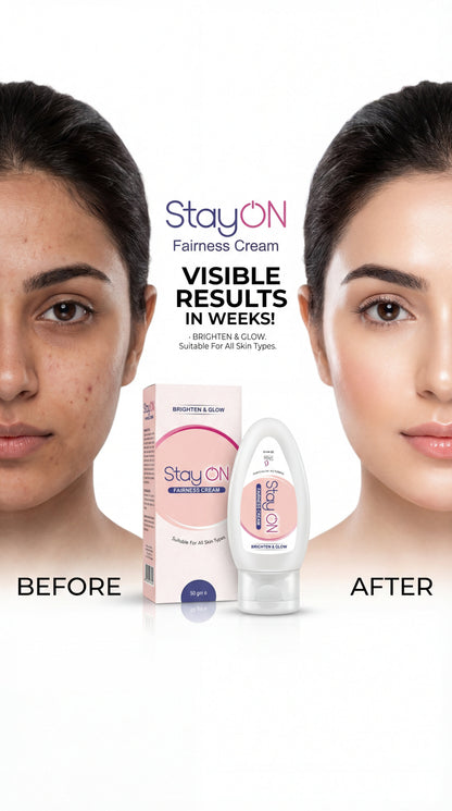 StayON Fairness & Glow Cream | Glutathione, Vitamin C, Arbutin & Melavoid | For Melasma, Pigmentation & Uneven Skin Tone