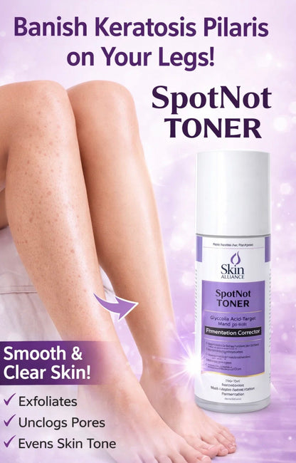 SpotNot Glycolic Acid Toner | Glycolic, Salicylic & Lactic Acid | Exfoliating Toner for Pigmentation, Acne & Smooth Skin