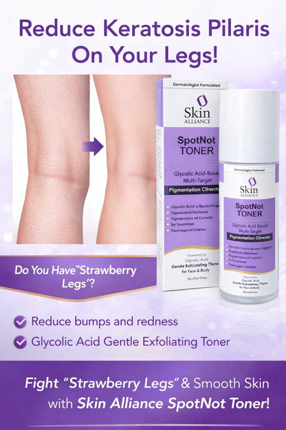 SpotNot Glycolic Acid Toner | Glycolic, Salicylic & Lactic Acid | Exfoliating Toner for Pigmentation, Acne & Smooth Skin