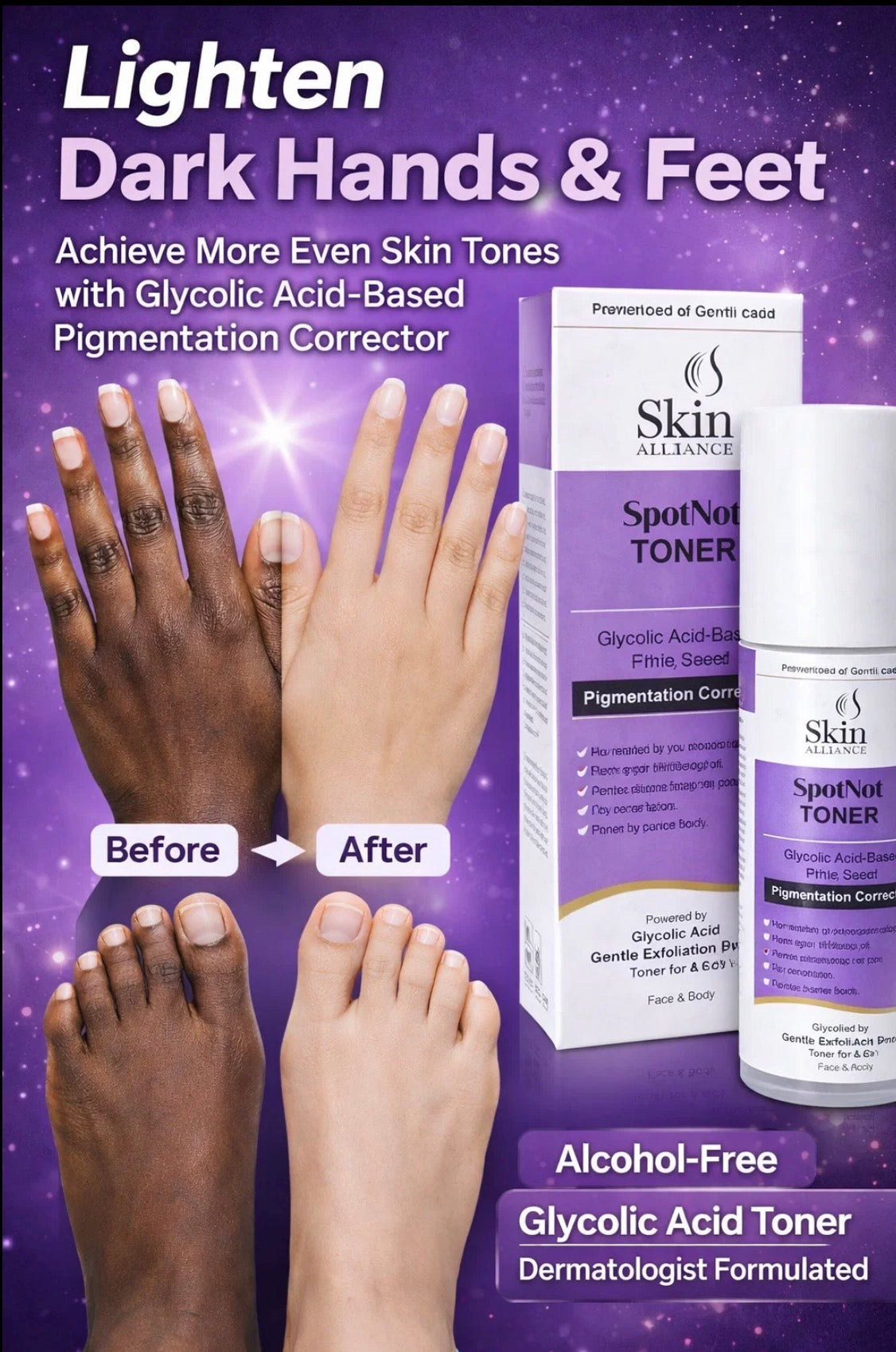 SpotNot Glycolic Acid Toner