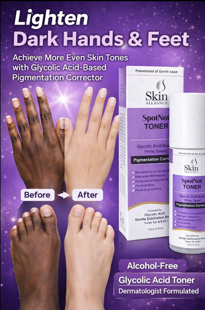 SpotNot Glycolic Acid Toner | Glycolic, Salicylic & Lactic Acid | Exfoliating Toner for Pigmentation, Acne & Smooth Skin