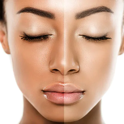 Glutathione for skin glow and detox